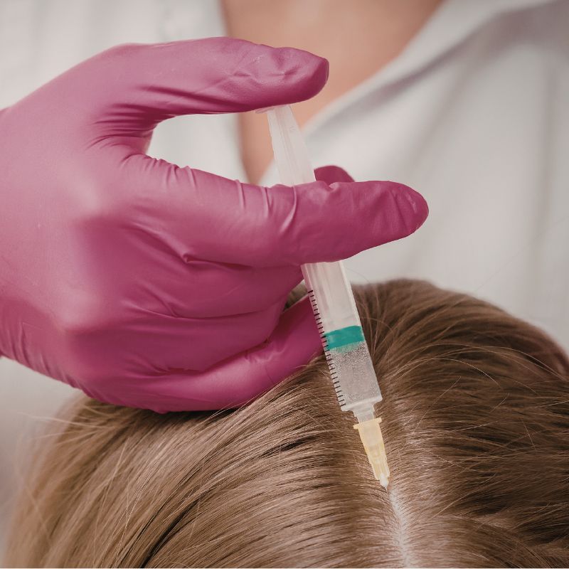 PRF Hair Restoration | The Treatment | Available in Newport Beach, San Clemente, Claremont, Redlands, and Henderson